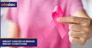 Swelling or lumps around your collarbone or armpits can be caused by breast cancer that has spread to lymph nodes in those areas. Is Every Breast Lump Cancerous Cancer Care Women S Health Oladoc Com
