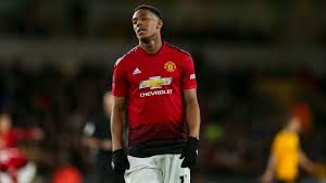 Anthony Martial 4 10 Defence Poor As Man United Crash Out Of Fa Cup Vs Wolves Anthony Martial Man United Fa Cup