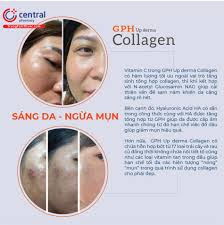 CHÍNH HÃNG] GPH Up derma Collagen - Khoẻ bên trong, đẹp bên ngoài