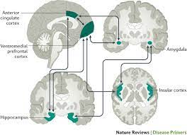 When blood vessels narrow, this is called vasoconstriction, and it can affect body temperature. Anxiety Disorders Nature Reviews Disease Primers