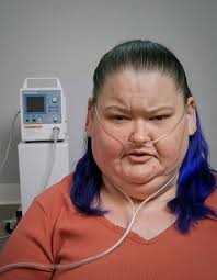 Shocking Tragedy😭: Amy Slaton of 1000-lb Sisters Beaten by Boyfriend,  Hospitalized with Brain Hemorrhage!👇👇  https://thelist.donextop.com/shocking-tragedy%f0%9f%98%ad-amy-slaton-of-1000-lb-sisters-beaten-by-boyfriend-hospitalized-with-brain  ...