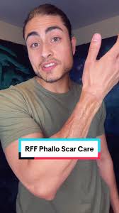 Phalloplasty Scar Care Tips for Trans Men