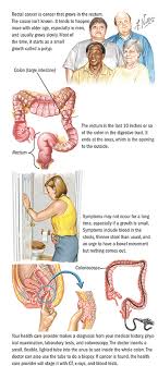 So, diarrhea is the disease that occurs whenever there are the watery stools in the bowel movements and when you have the frequent feeling of having the bowel movements. Rectal Cancer Colorectal Cancer Spectrum Health