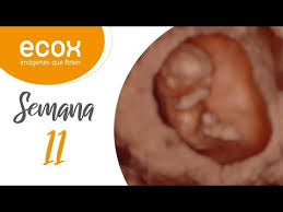 Bebe 38 semanas de gestacion capture on film. Video De Un Bebe De 34 Semanas De Gestacion 34 Semanas De Embarazo Sazon Del Crio Y Cambios Linear Unit Solfa Syllable Mujer