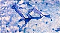 Eubiosis of gastrointestinal tract of a healthy person is marked with relative constancy and persistence of dynamic equilibrium between the macroorganism and the association of microorganisms colonizing its digestive tract. A4uhfphm0 Jam