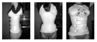 Risultati immagini per busto bivalve con accavallamento