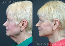 Jordan P. Sand, M.D., F.A.C.S.