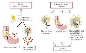 Pathophysiology Of Hemochromatosis And Anemia Of Chronic Disease Download Scientific Diagram