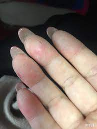 空手指、莲蓬乳是真的吗？