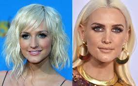 20.06.2021 · the origin of our plastic surgery suspicion. New And Improved The Top 15 Celebrity Plastic Surgeries For The Win