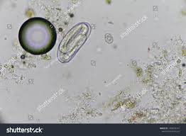 Image result for Strongyloides