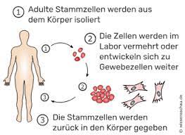 Drei Vorteile Und Nachteile Der Adulten Stammzellen Wissensschau De