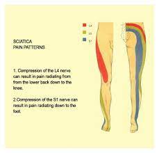 Pin On Pain Patterns