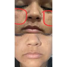 kit 6 sabonetes 2 Dolomitas, 2 Rosas mosquetas e 2 Açafrãos. em Promoção na  Shopee Brasil 2026