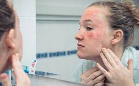 Kem mật ong Manuka 16+ Madeleine Ritchie: tin tức, hình ảnh, video, bình  luận mới nhất