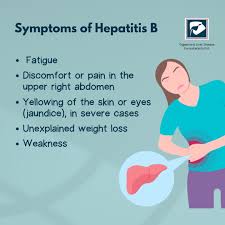 Image result for hepatitis symptoms