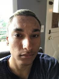 Hathai 2018 — Carpe Mundi