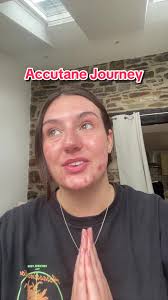 Aknepositivity: Mein Hautupdate während der Periode