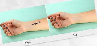 I can remove them now. How To Remove A Tattoo In Photoshop