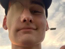 Fundraiser by John Walters : Help One Eye Guy!