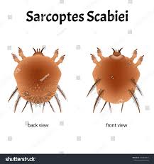 Image result for Sarcoptes scabiei
