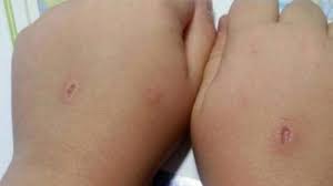 Algunos de los niños eran engañados para participar en el macabro juego , dijo prendes. Abecedario Del Diablo El Macabro Juego Ha Dejado Medio Centenar De Ninos Con Heridas