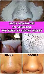 Yuzdeki Siyah Noktalar Nasil Temizlenir 2020 Siyah Noktalar Jelatin Dogal Cilt Bakimi