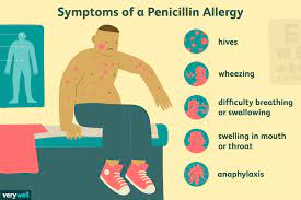 Children And Penicillin Allergic Reactions