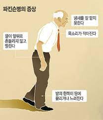 병의 진행속도를 늦추고 증상을 완화, 여생동안 다른사. íŒŒí‚¨ìŠ¨ë³' ì¹˜ë£Œ
