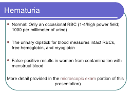Urinalysis 3 27