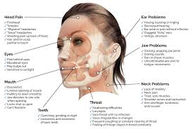 Image result for Jaw Claudication