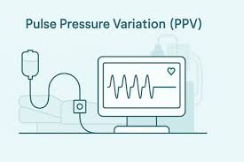 Image result for Pulse Pressure