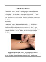 Bacille calmette guerin vaccine used to prevent tuberculosis and also given to prevent compications like such as meningitis in many countries. Tuberculin Skin Test Medical Specialties Clinical Medicine
