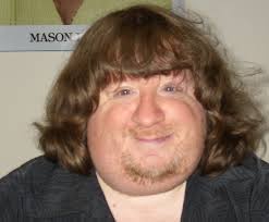Maybe you would like to learn more about one of these? Who Is The Ugliest Man In The World