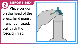 Mastering condom use- tips for uncircumcised men
