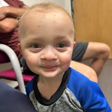 UMMC Pediatric Plastic Surgery