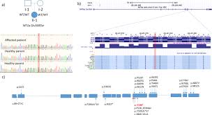 Sa robe, sa couleur, sa dentition, sa morphologie, mais aussi son comportement : Expansion Of The Gria2 Phenotypic Representation A Novel De Novo Loss Of Function Mutation In A Case With Childhood Onset Schizophrenia Journal Of Human Genetics