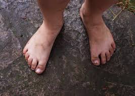 Image result for brown patches on the feet