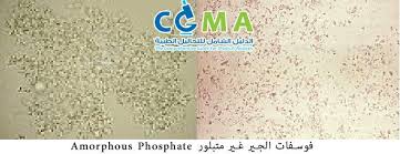 Amorphous Sphosphate Crystal Crystals Personal Care Person