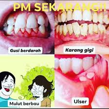 Dapatkan pemeriksaan berkenaan hal ini. Khas Untuk Mereka Yang Mempunyai Ubat Gigi Garam Buluh Facebook