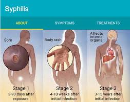 Image result for syphilis symptoms