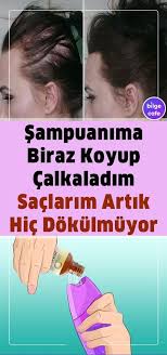 Sac Dokulmesini Hayatinizdan Komple Cikaran Bu Tarifi Mutlaka Denemelisiniz Sac Dokulmesi Sac Sac Dokulme Tedavileri