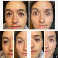 Catherine Wilkinson (@originaldancertoes) • Instagram photos and videos