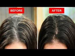 Turn White Or Gray Hair To Black Naturally Using Only 2 Ingredients Youtube Grey Hair Home Remedies Homemade Hair Dye Grey Hair Remedies