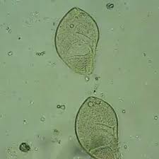 Image result for Balantoides Coli