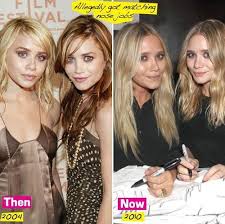 Olsen Twins Plastic Surgery Picture Plastic Surgery Plastic Surgery Plastic Surgery Pictures Olsen Twins