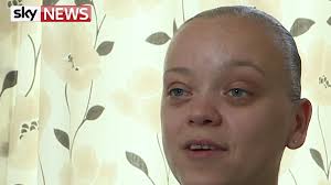 London acid attacks: Victim describes 'excruciating' assault, supports  tougher sentencing