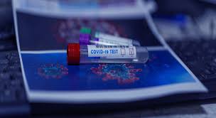 The pcr algorithm is cyclical. Q A What Is The Difference Between A Covid Pcr Test And A Lamp Test For Coronavirus