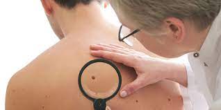 When to Visit a Dermatologist | Sutter Health