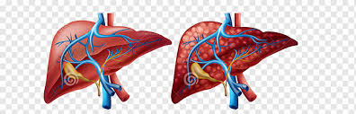 Diagram of body liver the india green tea market was valued at us 1 247 36 mn in and is projected to reach us 2 112 47 mn by it is the diagram below depicts a general algorithm for the workup albumin is exclusively made in the liver and if not lost from the body urine or gi sequestered or diluted a low. Liver Human Body Diagram Cirrhosis Organ Others Anatomy Liver Human Body Png Pngwing